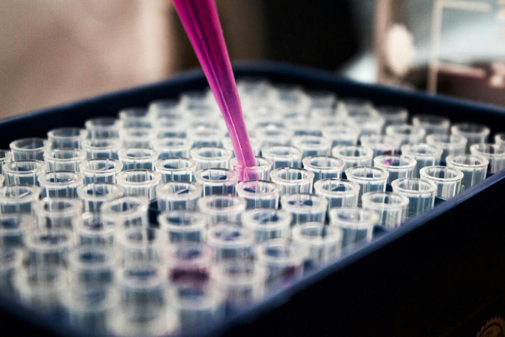 BioPorto Aktie